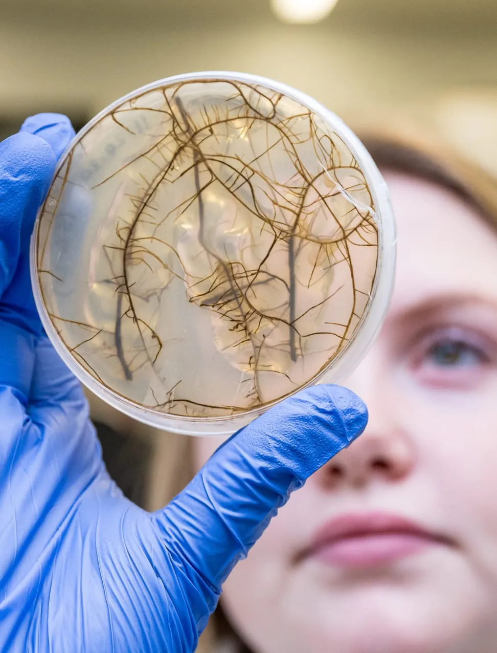 A lab worker holds up a petri dish filled with branching root structures for examination.